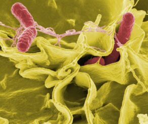 Salmonella Typhimurium invading cultured human cells - microscope view