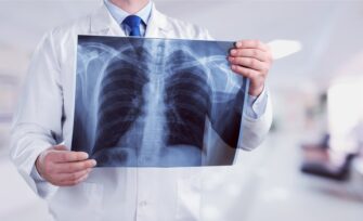 woodstock attorney x-ray